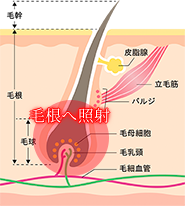 IPL方式