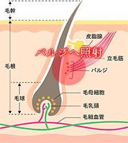 HS方式