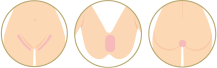 VIOセット