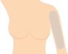 両ひじ上