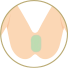 Iライン